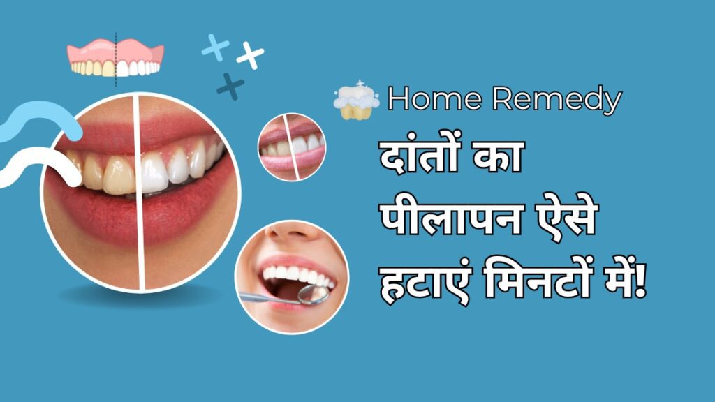 Home Remedy: दांतों की पीलापन ऐसे हटाएं मिनटों में!